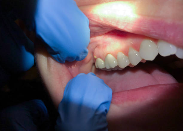 Best Emergency Dentist for Knocked-Out Tooth in Mililani Town, HI