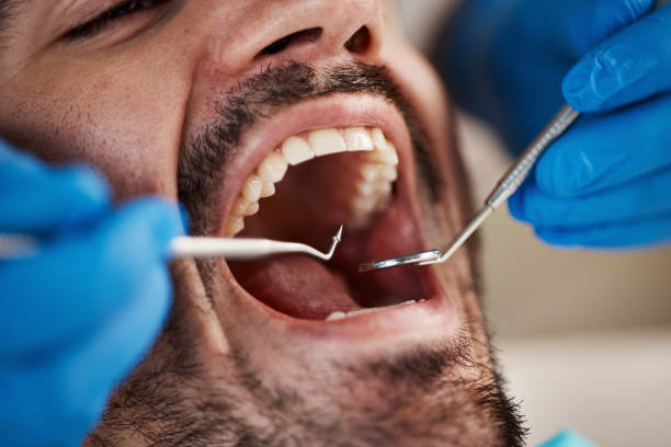Best Emergency Dental Extractions in Mililani Town, HI